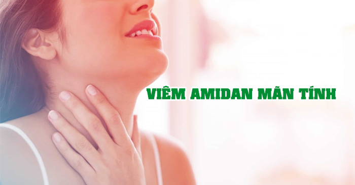 Viêm amidan mãn tính có những triệu chứng nặng và khó điều trị hơn so với giai đoạn cấp tính