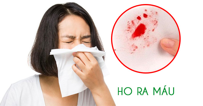 Ho ra máu là bệnh gì? 